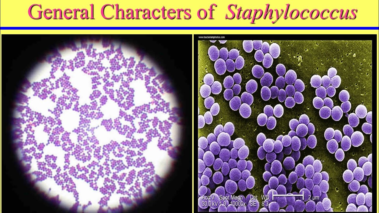 محاضرة البكتيريا العنقودية Staphylococci