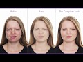 Cover acne  scars makeup tutorial for acne  jane iredale