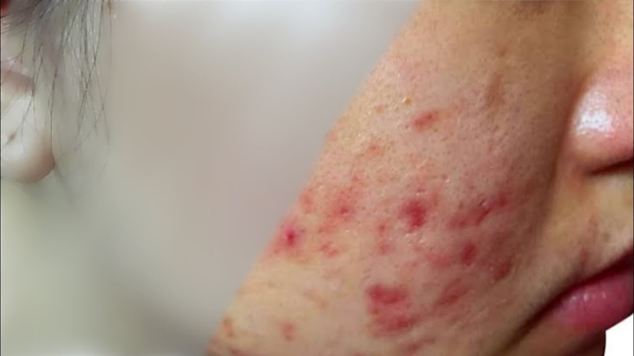 how to clean pimple // oily skin photo editing // smooth face photo editing / oil paint face editing