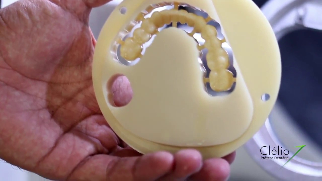 Provisório em CAD CAM - YouTube