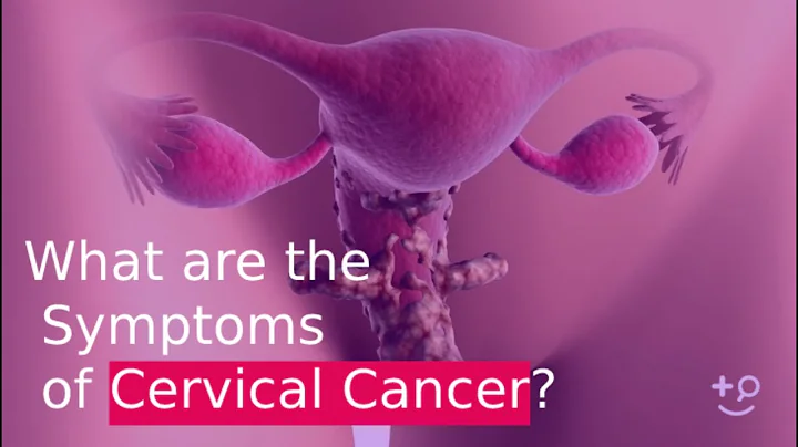 What are the Symptoms of Cervical Cancer? - DayDayNews