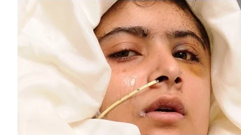 Malala Yousafzai, 16, and Her Miraculous Story of Surviving Being Shot by the Taliban