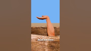 He Died 6 Times And Still Came Back 😱