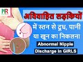 Nipple discharge in girls in hindi | अविवाहित लड़कियों में  स्तन  से दूध, पानी या  खून का निकलना |
