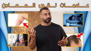 علامات تحذيرية تدل على انك بحاجة الى هذه المعادن، لا تتجاهلها أبداً