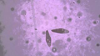 Blepharisma
