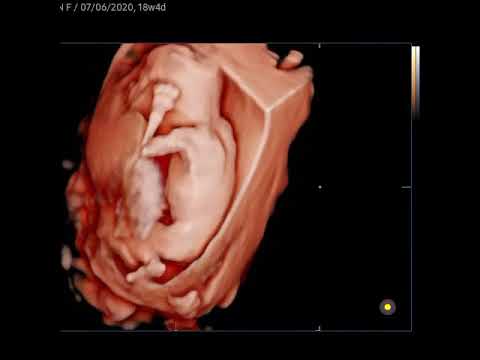 Bebe De 18 Semaines Institut Maia Youtube Bebe De 18 Semaines Institut Maia Youtube