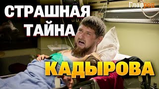 Шок! Кадирова не врятувати? Таємниця його хвороби розкрита!