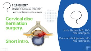 Cervical disc herniation. Short intro to surgery setup and execution.