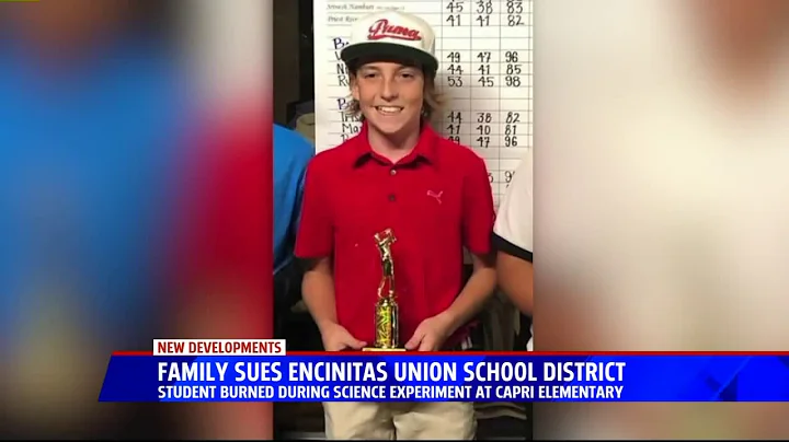 Family Sues School District After Boy Burned in Experiment Gone Wrong