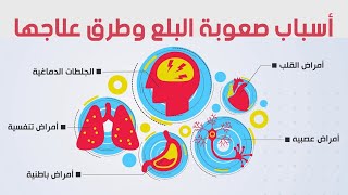 صعوبة البلع