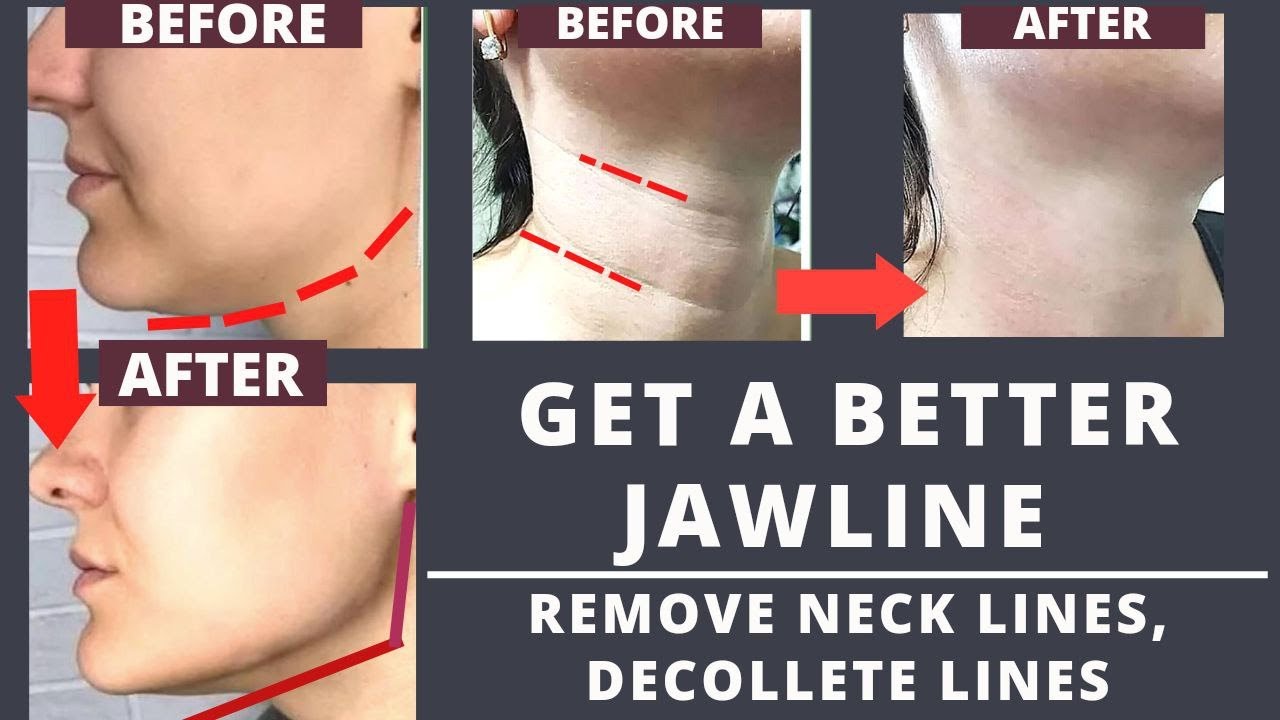 Get a better Jawline Remove Neck Lines Decollete lines YouTube