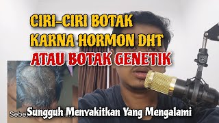 Ciri-ciri Kebotakan Yang Disebabkan Hormon DHT / Botak Genetik / Botak Keturunan