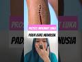 proses menjahit luka pada kaki manusia #zarooratrishta