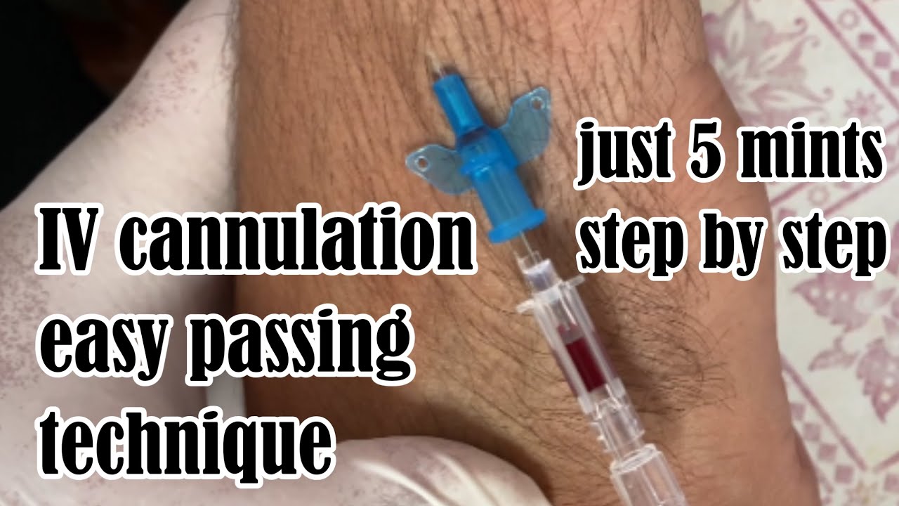 IV cannulation passing easy technique just 5 mints step by step - YouTube
