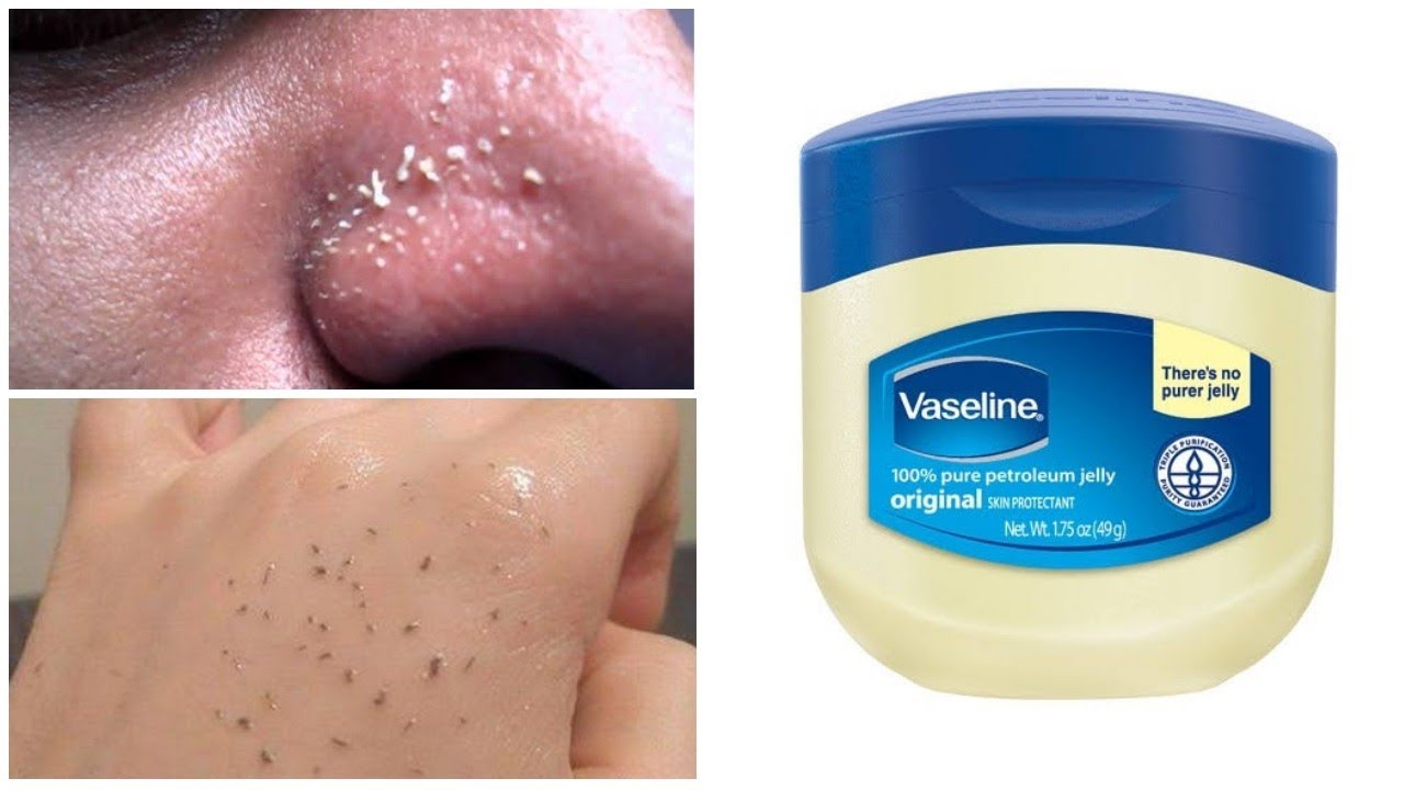 Kebaikan vaseline untuk muka