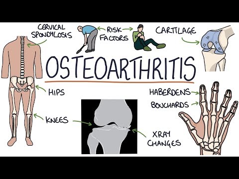 Video: Stoffwechselprofile Induzierter Pluripotenter Stammzellen Von Patienten Mit Rheumatoider Arthritis Und Osteoarthritis