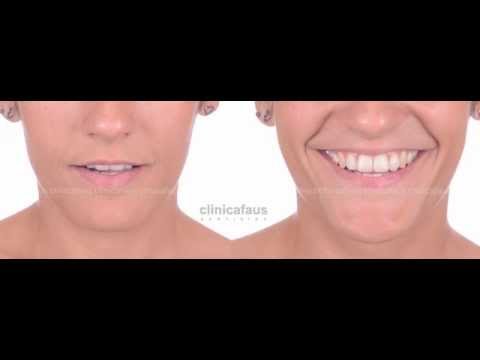 Tratamiento de ortodoncia