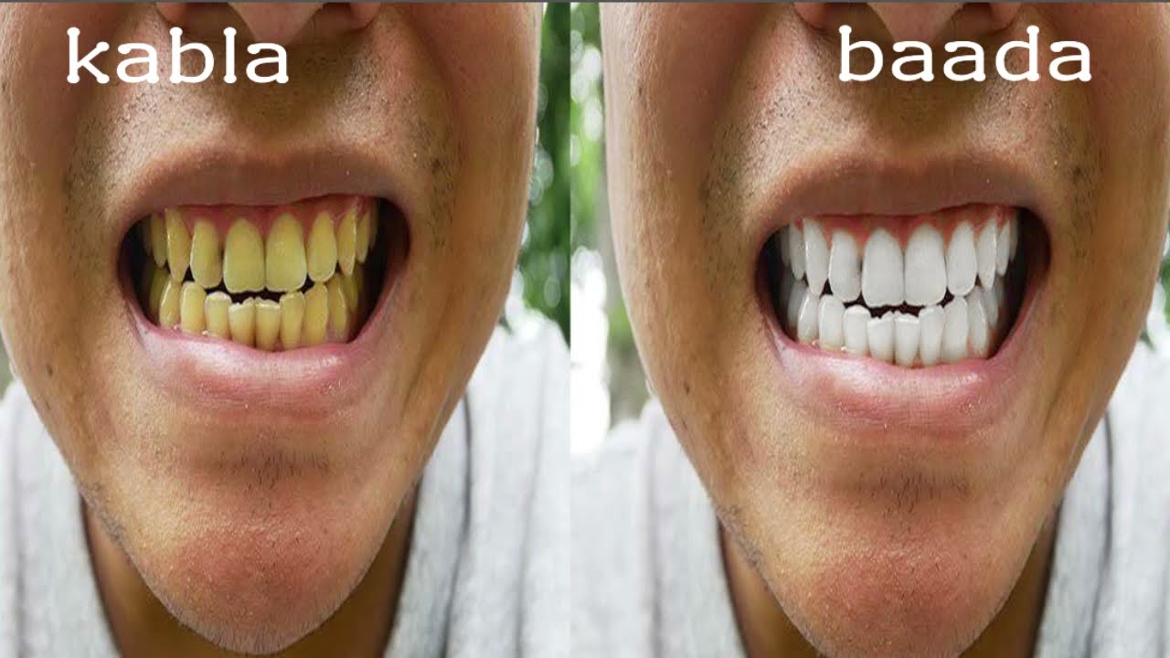  jinsi ya kung'arisha meno kwa adobe photoshop/The BEST Way to Whiten Teeth in Photoshop