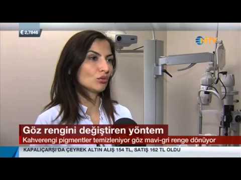 Göz Renginin Değiştirilmesi / 20.03.2015