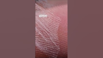 Skin Peeling Macro Closeup – Relaxing ASMR