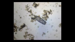 Difflugia giganteacuminata (Amoeba); bright field, dark field and oblique illumination