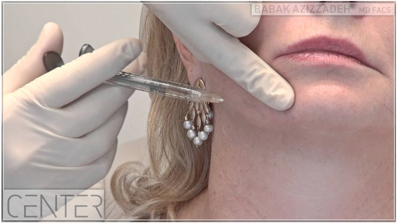 NonSurgical Jowl and Jawline Lift Dr Babak Azizzadeh in Beverly Hills YouTube