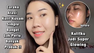 Skincare Lokal Untuk Mencerahkan Kulit Kusam | Medglow Platinum Whitening Series Review