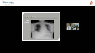 Acute Chest Pain | Manipal Health Diaries | Top Hospital In Delhi - Manipal Hospitals Delhi screenshot 2