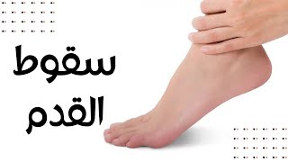 سقوط القدم - FOOT DROP: ماذا يُقصد بـ«سقوط القدم» وكيف نتعامل معه؟