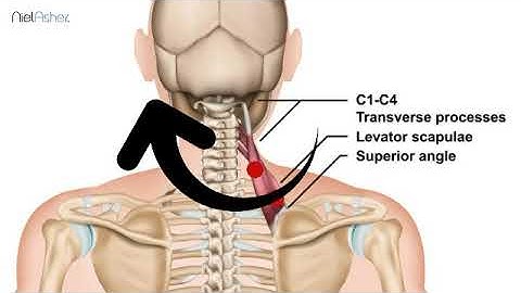 Levator Scapulae - Trigger Point Anatomy