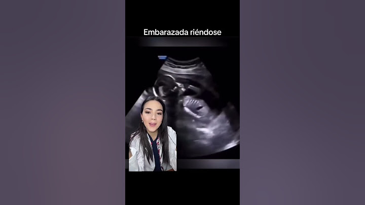 Cómo se ve un #bebe cuando #mama #embarazada se ríe #feto 🤰🏻🫨🤪