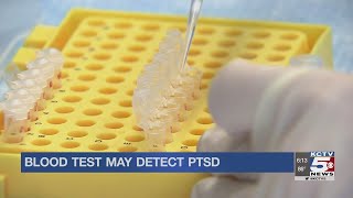 New blood test might help detect PTSD in veterans, first responders earlier