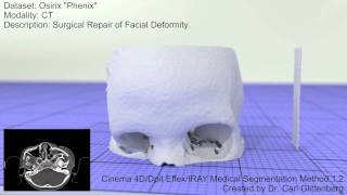 Medical Segmentation In Cinema 4D using DPIT EFFEX and IRAY