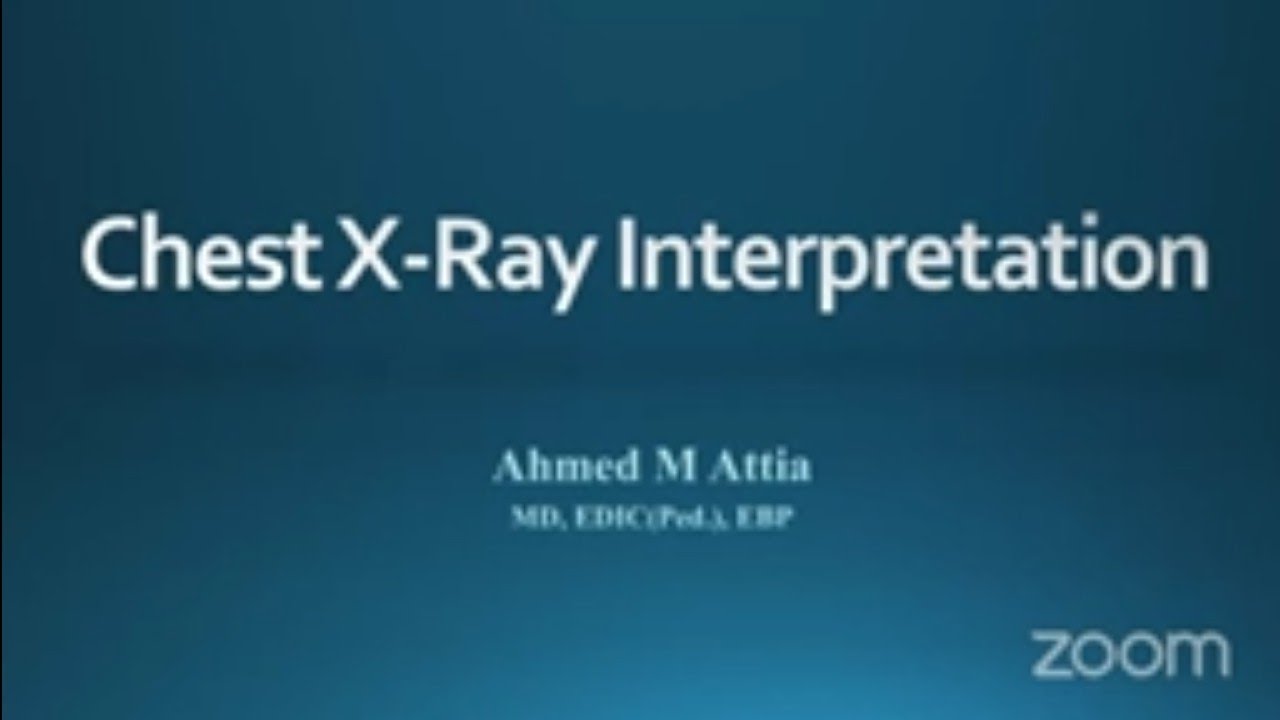 Chest x-ray interpretation for young pediatrician part 1 Dr Ahmed Attia