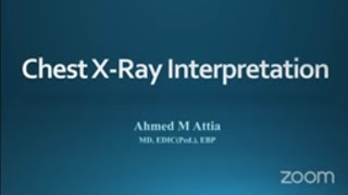 Chest x-ray interpretation for young pediatrician  part 1 /Dr Ahmed Attia