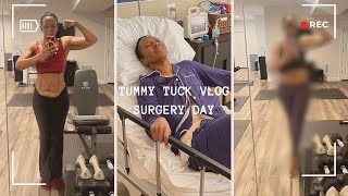 I Had a Tummy Tuck and This Is What Happened