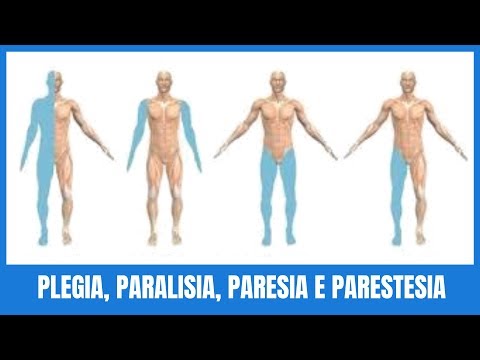 hqdefault - Diferença entre Plegia, Paralisia, Paresia e Parestesia
