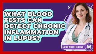 What Blood Tests Can Detect Chronic Inflammation in Lupus? | Lupus Wellness Guide