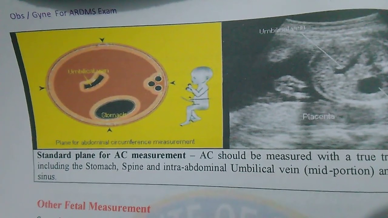 AC Abdominal Circumference Measurements Indications In Ultrasound AC Abdominal Circumference Measurements Indications In Ultrasound