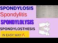 Spondylosthesis Spondylitis, Spondylolysis &amp; Spondylosthesis in Detail ✅