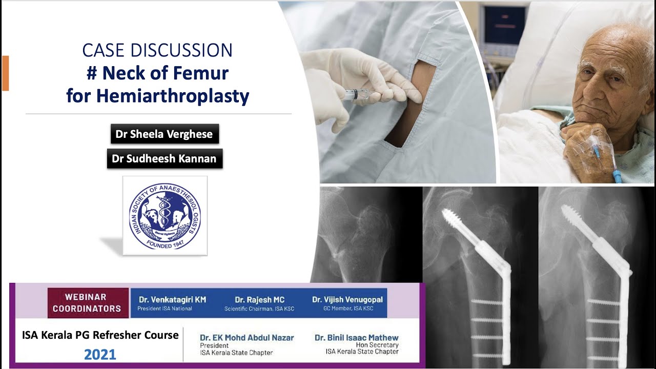 Fracture neck of femur for hemiarthroplasty - Case Discussion | Kerala ISA PG Refresher Course 2021