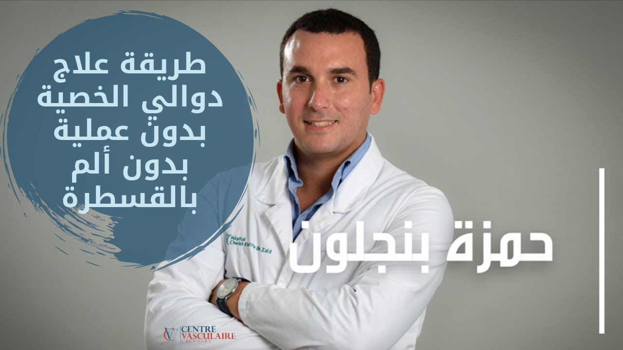 تعرفوا على طريقة علاج دوالي الخصية بدون عملية بدون ألم بالقسطرة I varicocèles, embolisation au Maroc