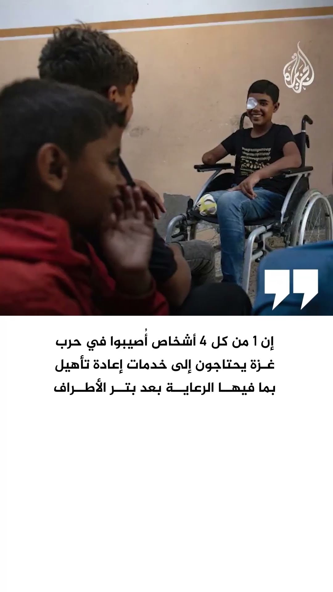 مسؤولون أمميون: أعلى نسبة أطفال مبتوري الأطراف بالعالم موجودة في غزة