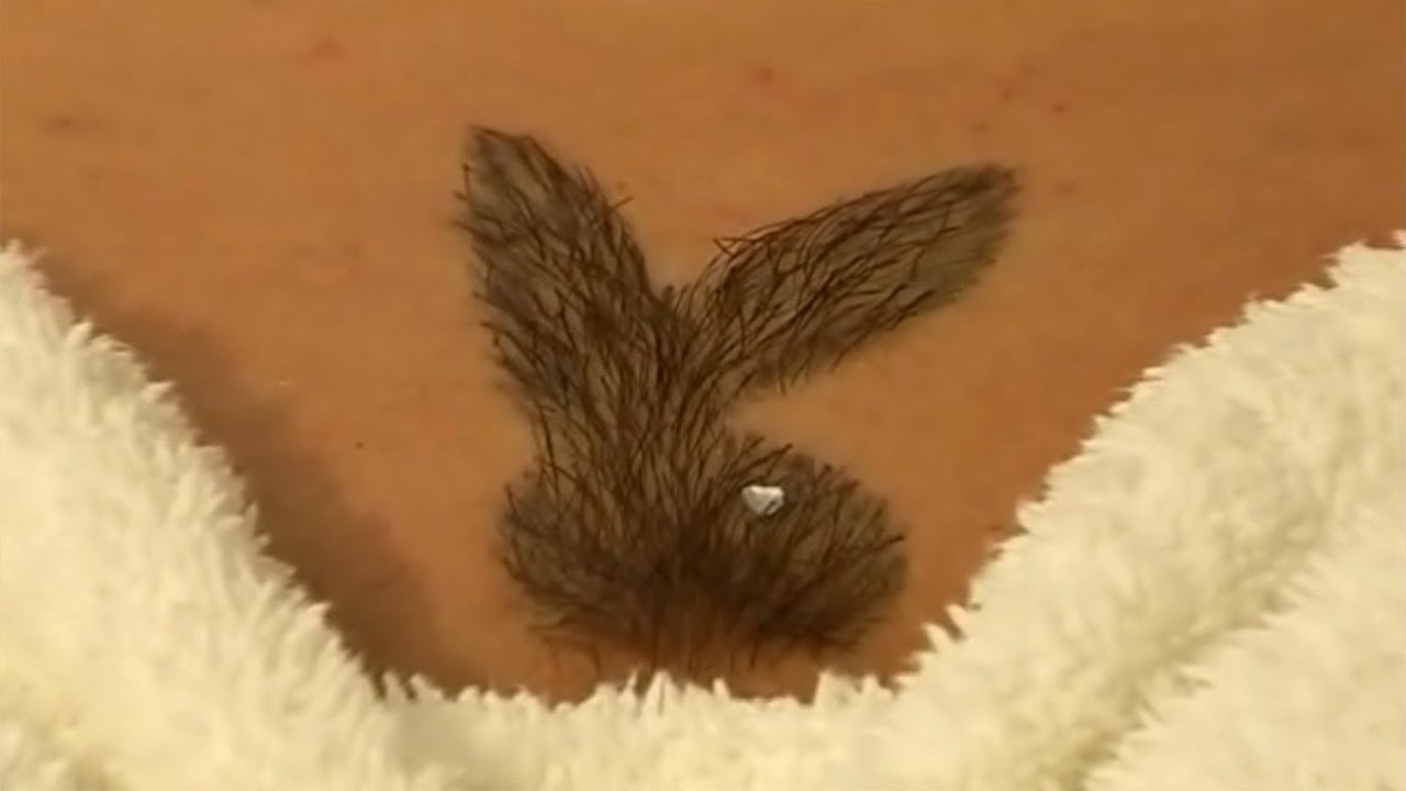Лобки 