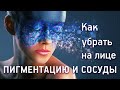 «Как убрать пигментацию и сосуды на лице»