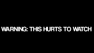 Whoopsies Meme Original Sticknodes