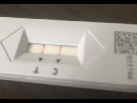 快篩陽性中標確診者的CALL IN她用自身經驗踢爆政府真相? / BNT買輸郭董？藥師開酸：不會買就交給有經驗的人買 /