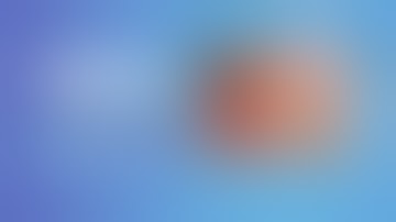 Caldwel luc approach from maxilla for removing cyst in the para nasal sinus surgery video - Dr Sunil