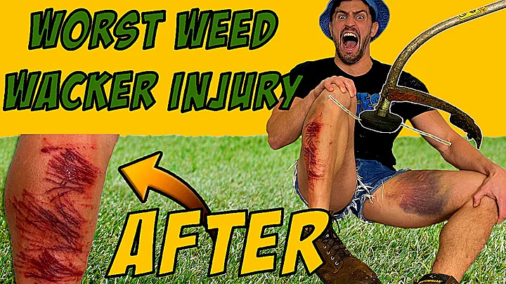 Creating the WORST WEED WACKER INJURY of all Time *PURE AGONY* | Bodybuilder VS Weed Eater Test